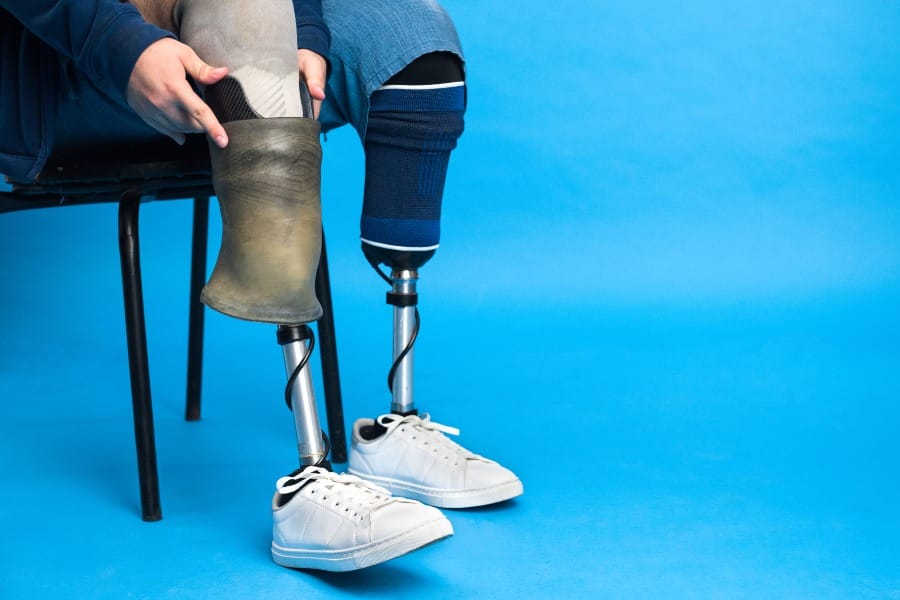 A man is in the process of removing one of his prosthetic limbs, showcasing the use of medical appliances for mobility assistance.
